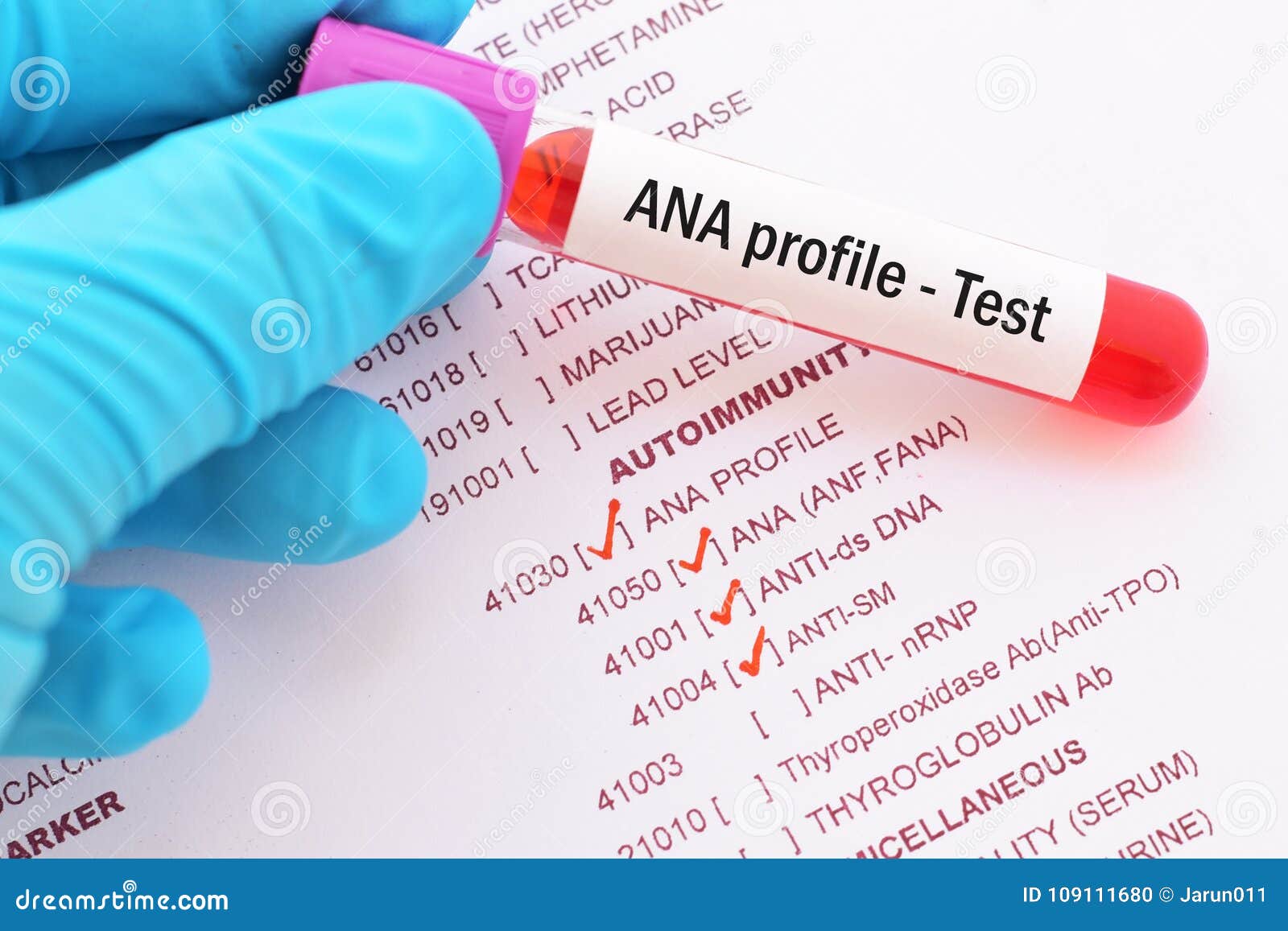 Какая ты кровь тест. Ana-Test. Ana тест крови. Ana профиль кровь.