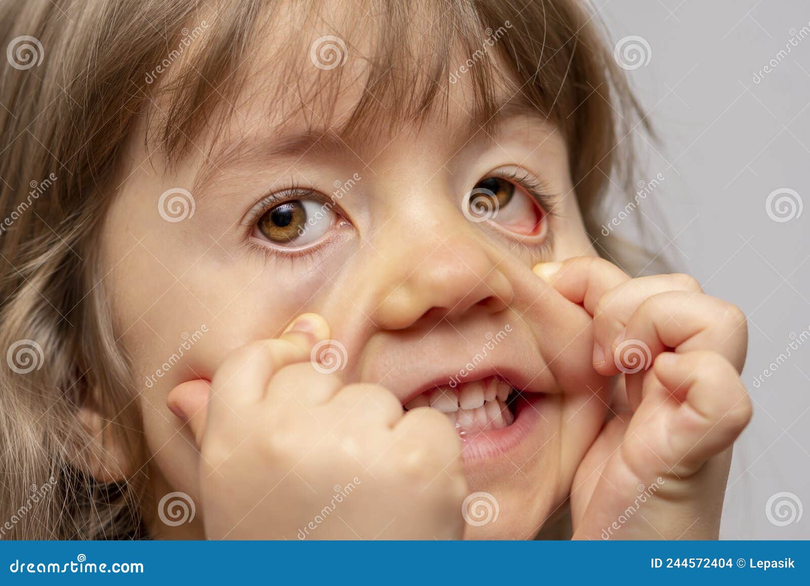 маленькая девочка гримакес, и делает страшные лица и растягивает кожу на  лице под глазами. Стоковое Фото - изображение насчитывающей человек,  красивейшее: 244572404