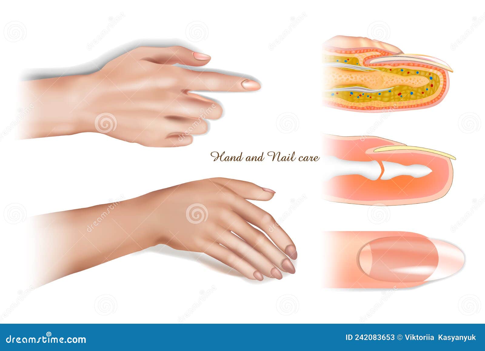 Панариций (воспаление когтевого ложа). Паронихий -воспаление ногтевого валика. Панариция околоногтевого. Ногти пульсируют. Околоногтевой панариций.