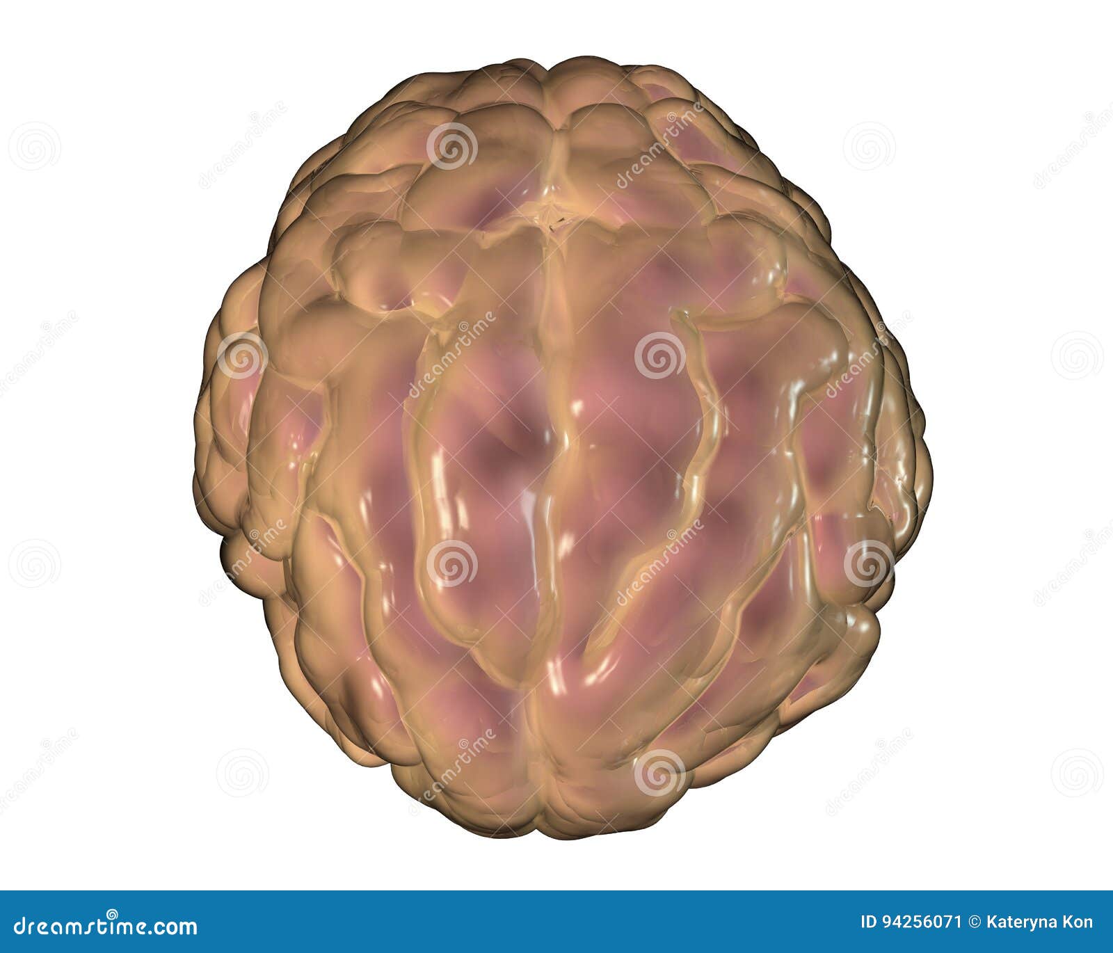 Воспаление головного мозга латынь. Менингит у человека мозг.