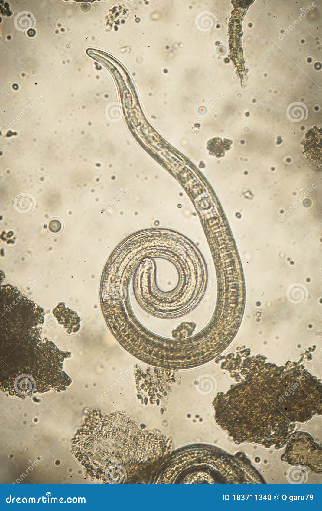 Как выглядит трихинелла под микроскопом Микроскоп червя Spiralis Trichinella паразитный Nematoda Стоковое Фото - изображ