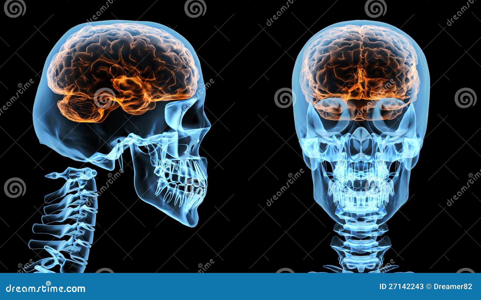 Brain 164. Головной мозг человека в черепе. Расположение мозга в черепной коробке.