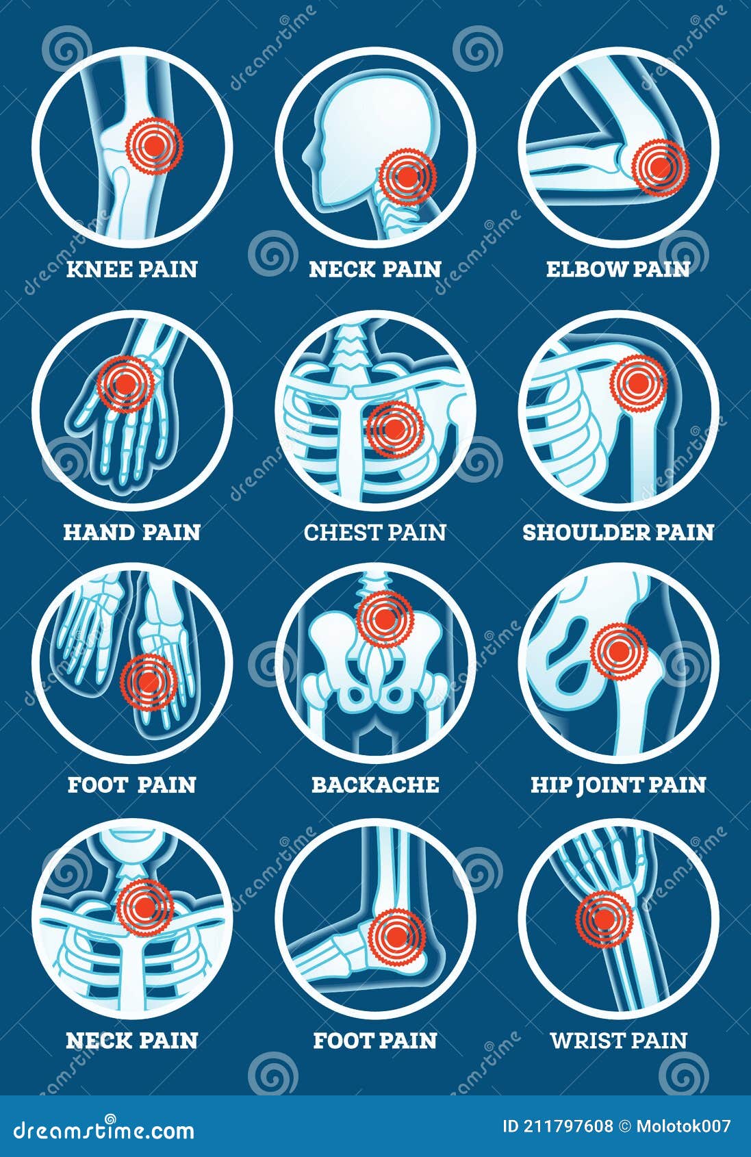Набор боли тела. Боль в груди и шеи, плеч кисть руки, ноги Backache  тазобедренного сустава колена локтя Иллюстрация вектора - иллюстрации  насчитывающей метка, рука: 211797608