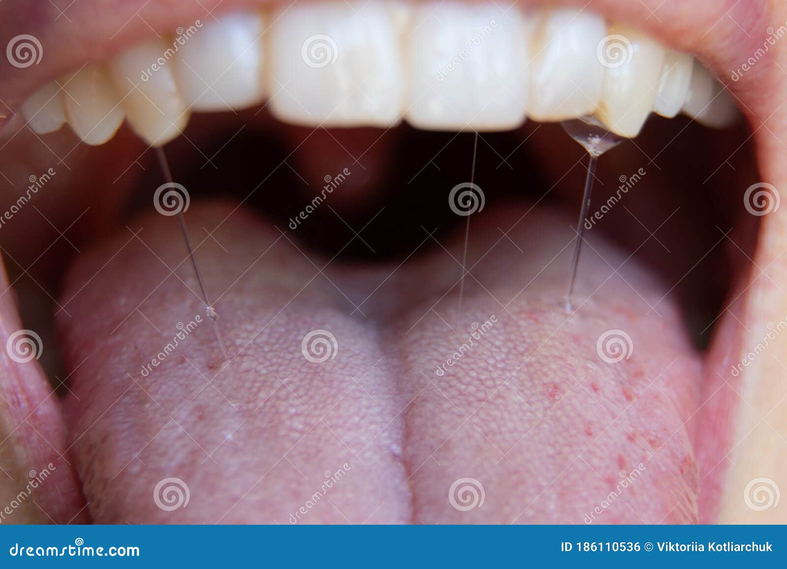 девочки mouth 