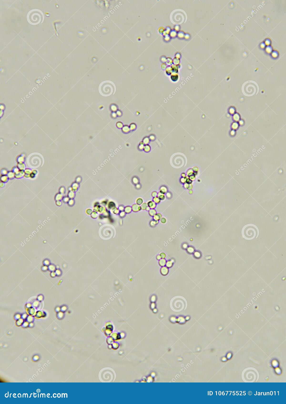 Споры candida. Грибок Candida в моче. Дрожжевые грибки в моче. Грибки в моче микроскоп.