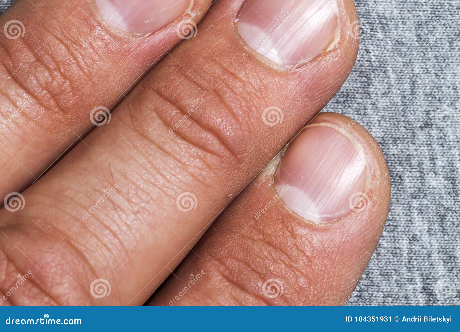 Ногти Человека Фото