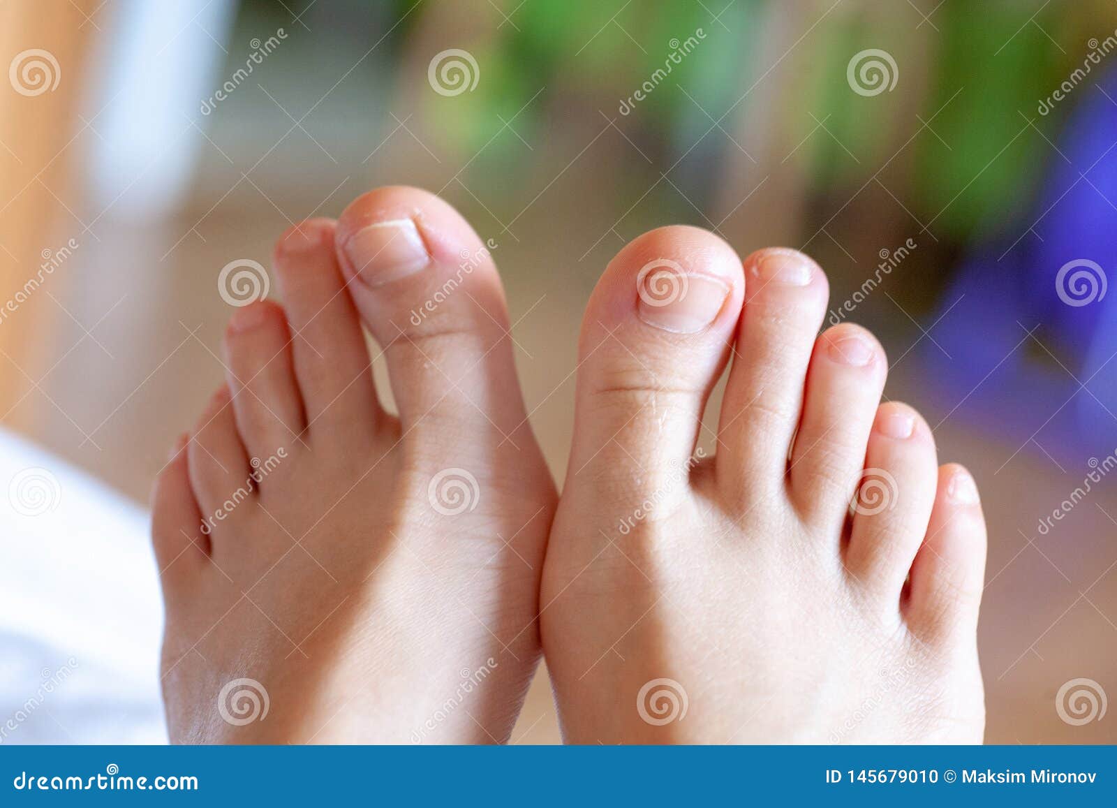Пальцы Ног Женщин Фото
