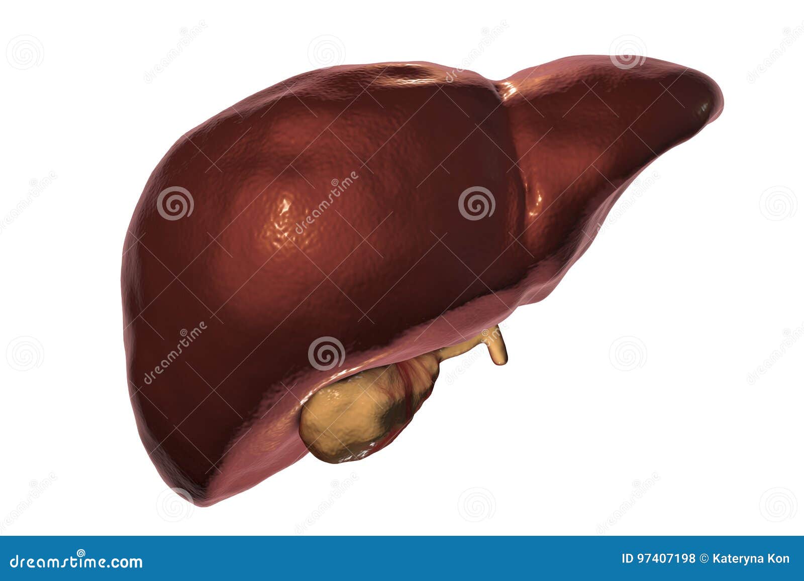 Фиброз гепатоз печени цирроз. Белое пятно на печени что это. Белое пятно на печени что это. Гемангиома печени микро. Белое пятно на печени что это.