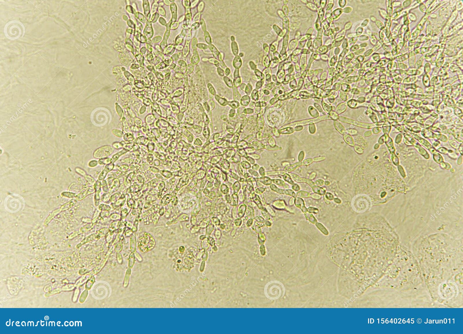 Дрожжевые клетки в моче повышены. Мицелий кандида. Грибы кандида лептотрикс. Грибы в моче под микроскопом. Дрожжевые грибы в моче.