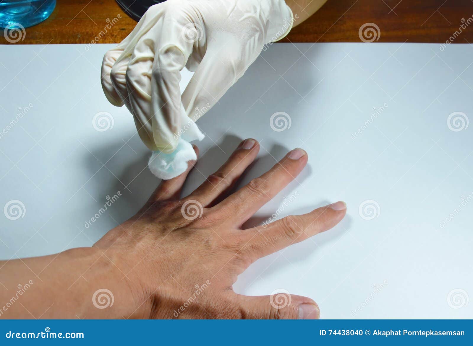 От чего потеют руки. Потные руки в перчатках. Потные резиновых перчатка. Рука в медицинской перчатке. Перчатки от потения рук.