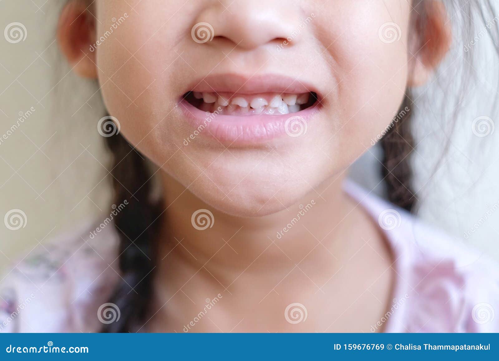 Зубы В 6 Лет Фото