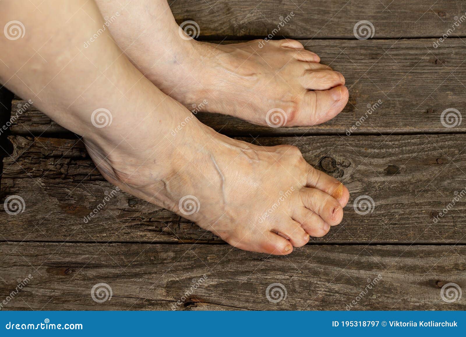 1174 Old Lady Feet Stock Photos & High-res Pictures