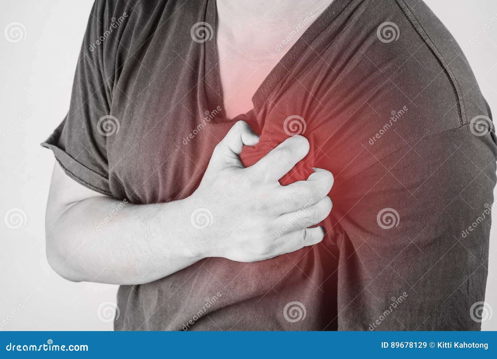 боль под левой лопаткой. боль в левой грудной мышце. межреберная невралгия евдокименко.