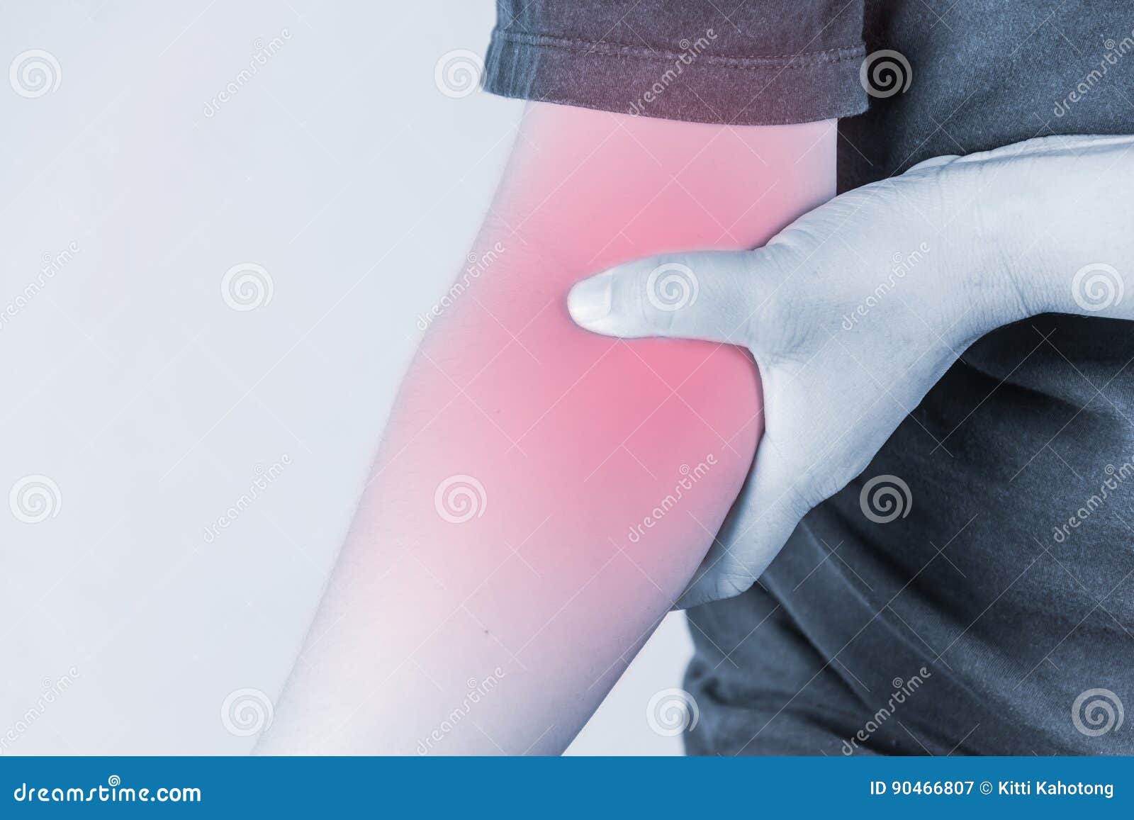 Локтевой нерв левой руки. Кубитальный канал локтевого сустава. Неврит (невропатия) локтевого нерва. Защемление ротового нерва. Защемление ротового нерва.