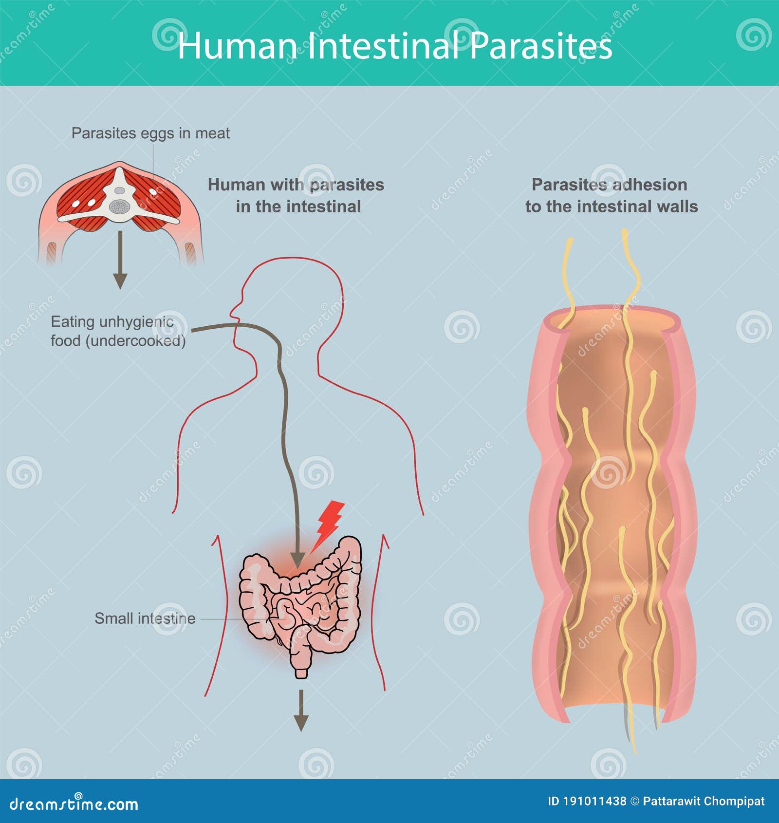 Știai că poți avea un parazit intestinal fără să-ți dai seama?