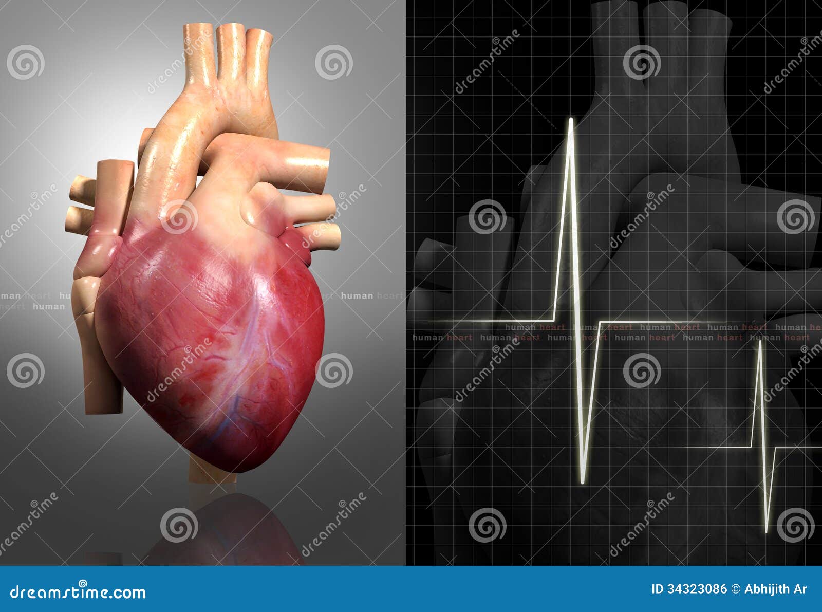 Сломать печать сердце. Израильская кардиология.