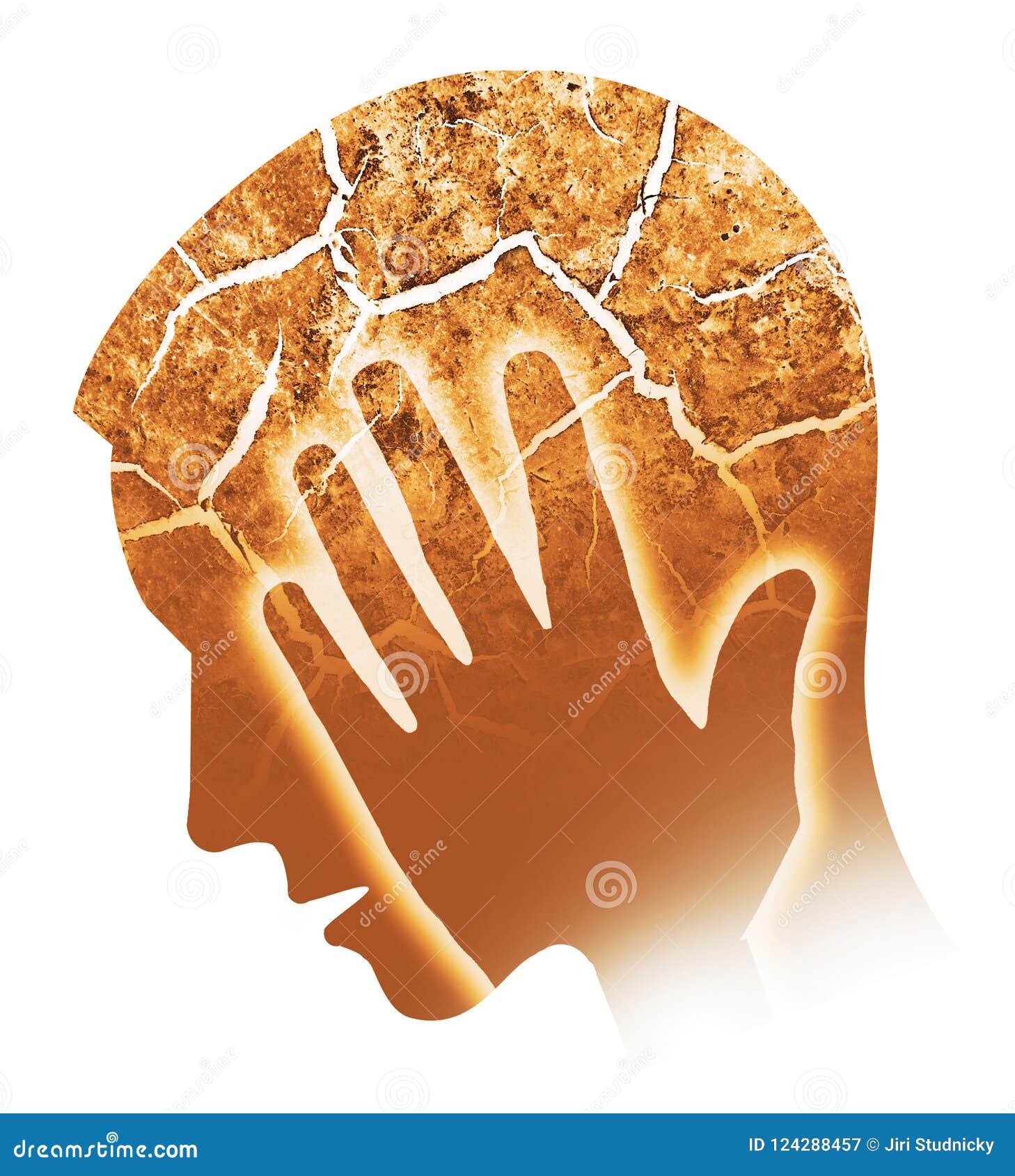 人偏头痛 头疼 烧光库存例证 插画包括有裂缝 沮丧 破裂 难受 背包 格朗基 干燥