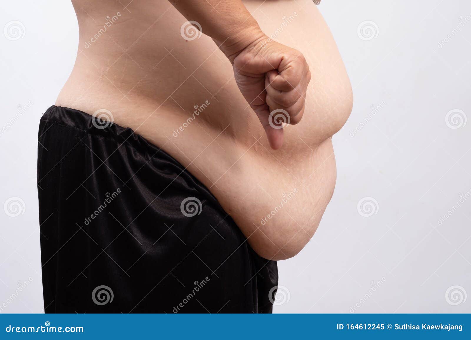 女性体型很胖保健概念库存图片 图片包括有营养 丢失 肥胖病 女孩 白种人 失败 脂肪团 女性体型很胖保健概念库存图片 图片包括有营养 丢失 肥胖病 女孩 白种人 失败 脂肪团