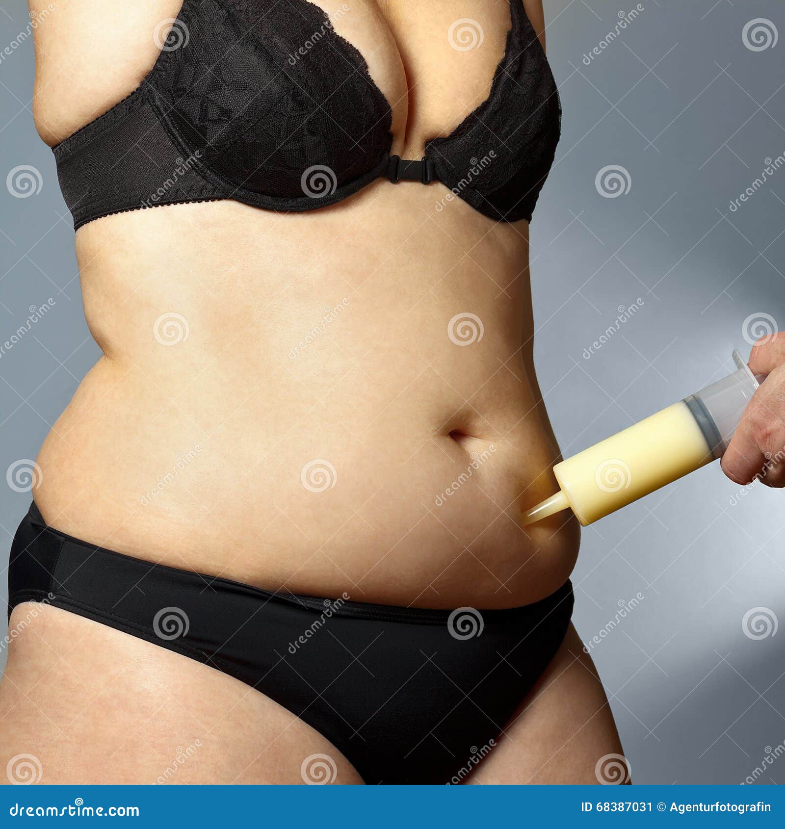 妇女肥胖腹部皮下脂肪切除术注射器库存图片 图片包括有现有量 成熟 女性 肥胖 医生 正横 妇女肥胖腹部皮下脂肪切除术注射器库存图片 图片包括有现有量 成熟 女性 肥胖 医生 正横