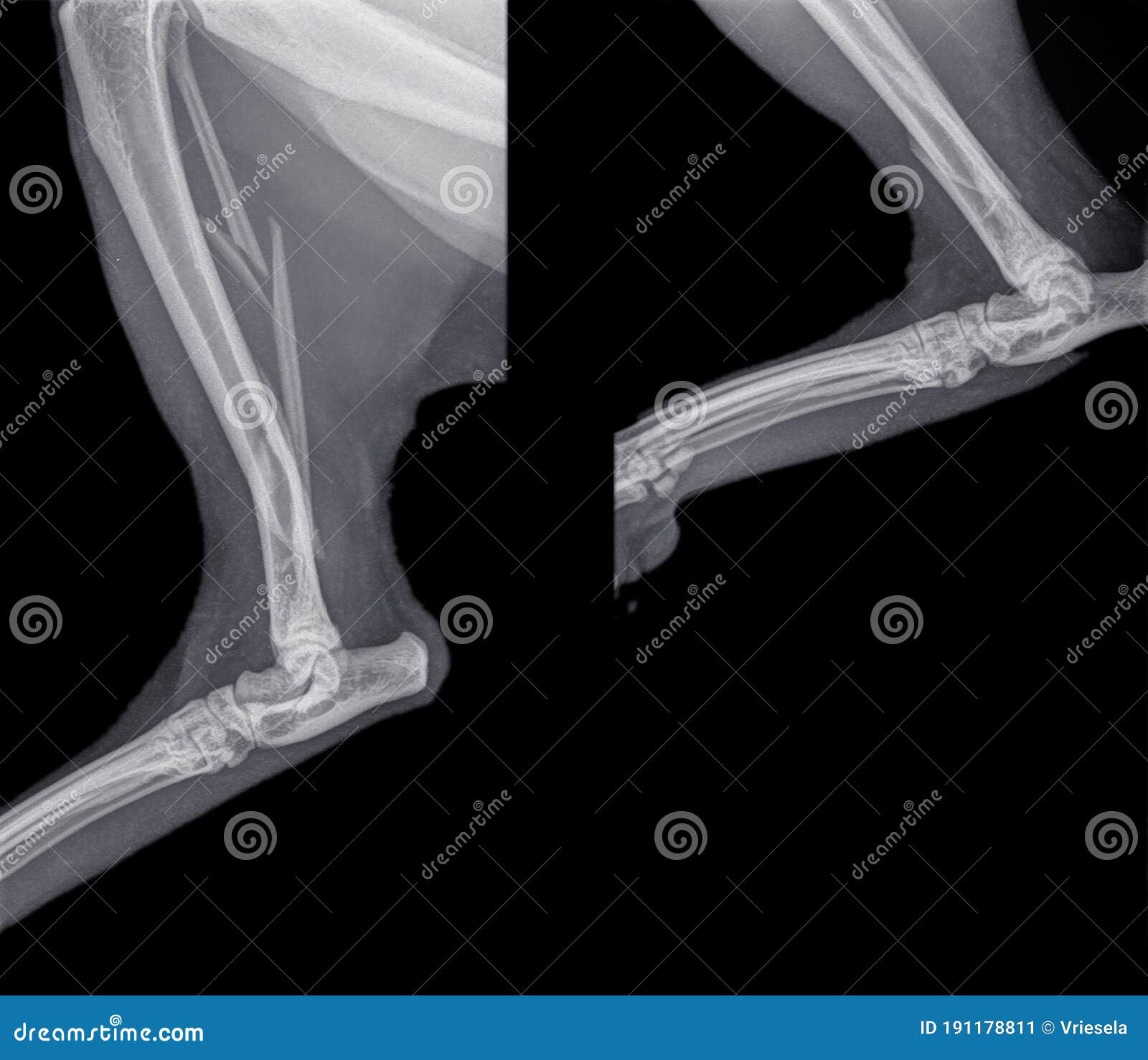 小牛腓骨骨折猫后腿的x线观察库存图片 图片包括有联接 查出 人力 图象 健康 腓骨 医疗