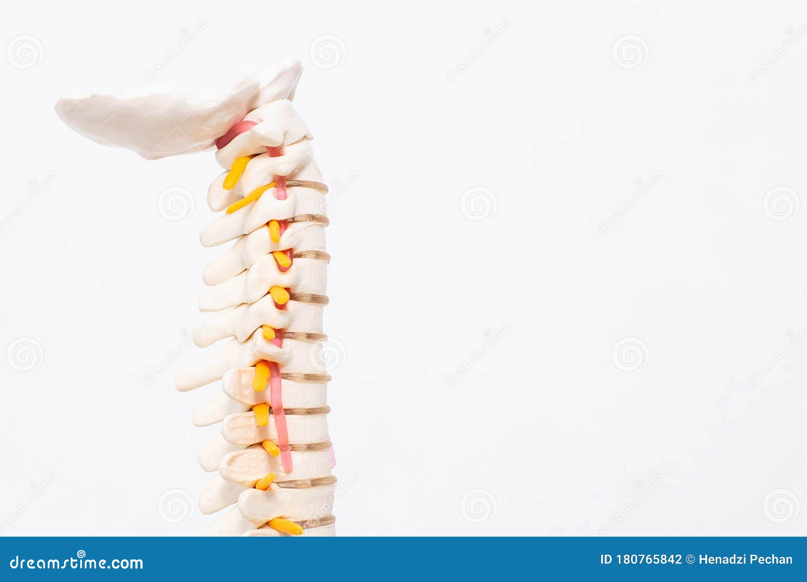 白背景下带血管的颈椎模型颈椎病与颈椎病的概念库存照片 图片包括有爱好健美者 疝气 形成弧光的 白背景下带血管的颈椎模型颈椎病与颈椎病的概念库存照片 图片包括有爱好健美者 疝气 形成弧光的