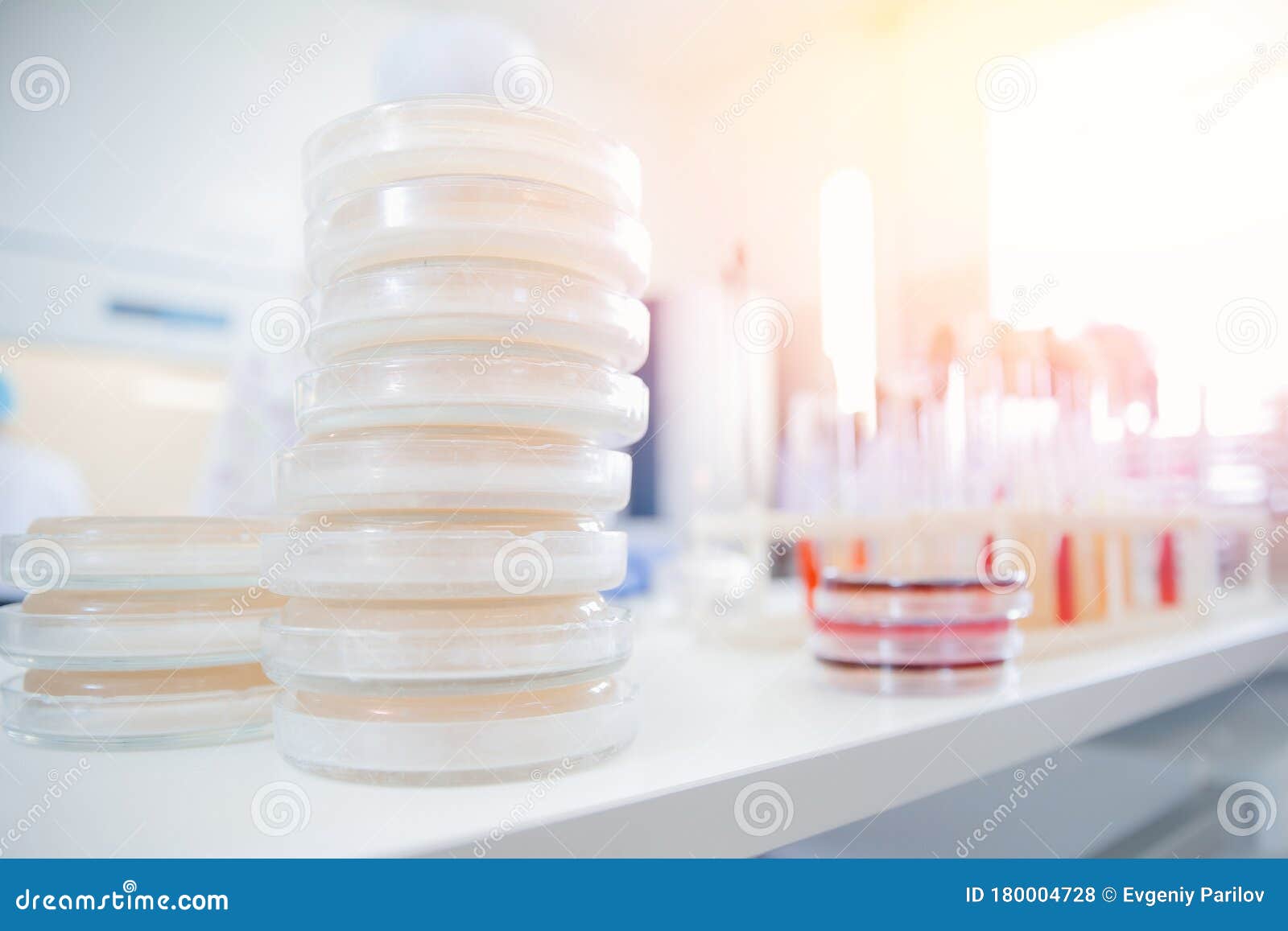 白背景琼脂培养基培养微生物实验室酵母库存照片 图片包括有脑膜炎 发展 卫生学 双眼 检验 白背景琼脂培养基培养微生物实验室酵母库存照片 图片包括有脑膜炎 发展 卫生学 双眼 检验