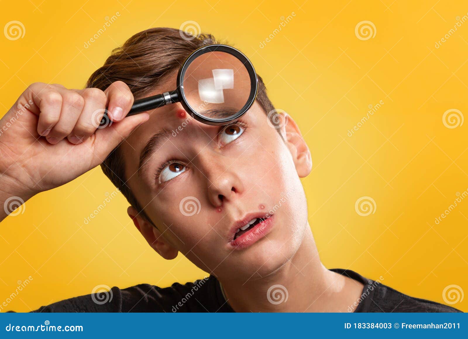 美容 皮肤和痤疮穿黑色t恤 脸上有皮条的少年 拿着放大镜对着他库存图片 图片包括有激怒 伤疤 美容 皮肤和痤疮穿黑色t恤 脸上有皮条的少年 拿着放大镜对着他库存图片 图片包括有激怒 伤疤