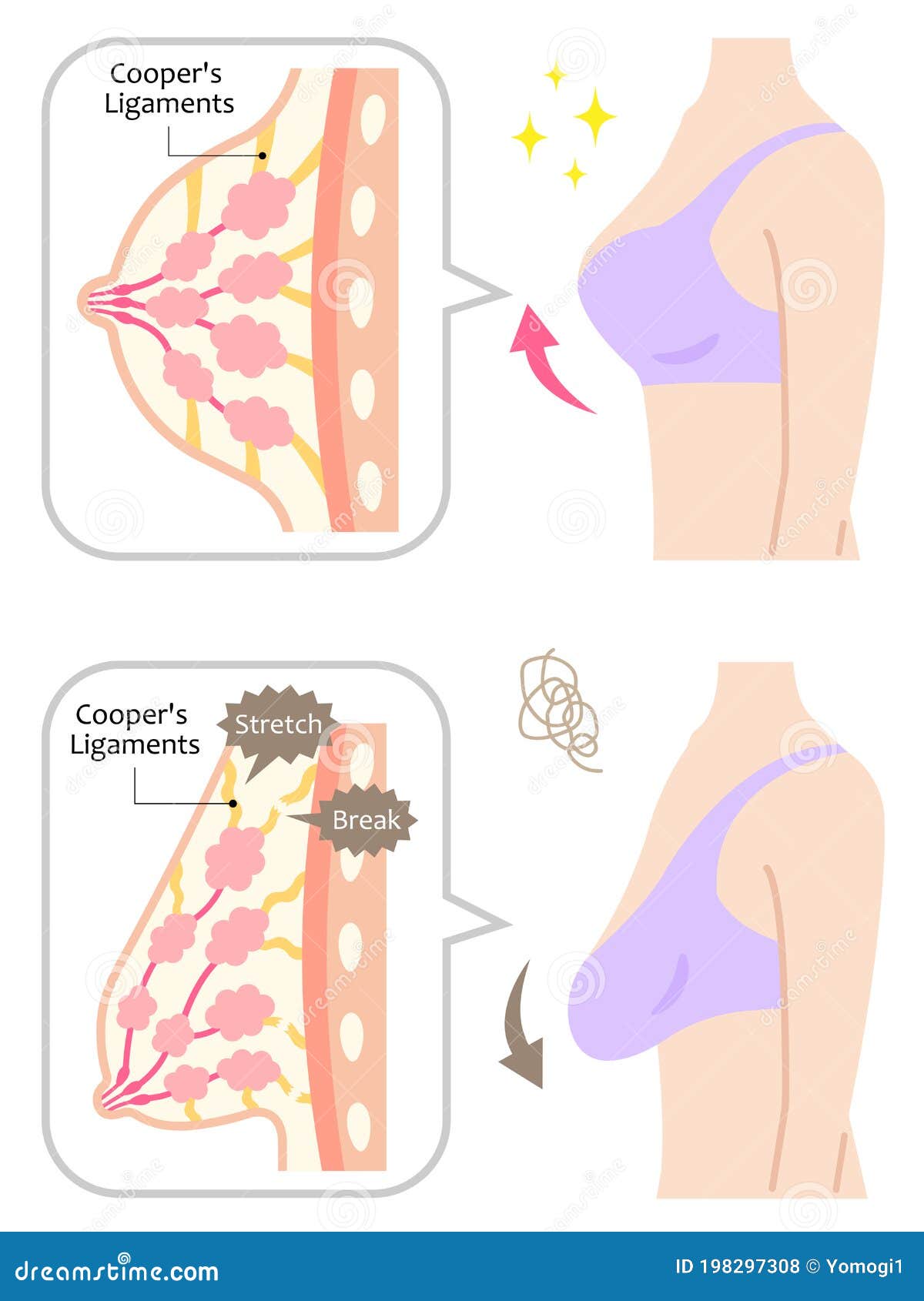 Diagram of Wooman Breasts with Upper Body. Beauty Body Care