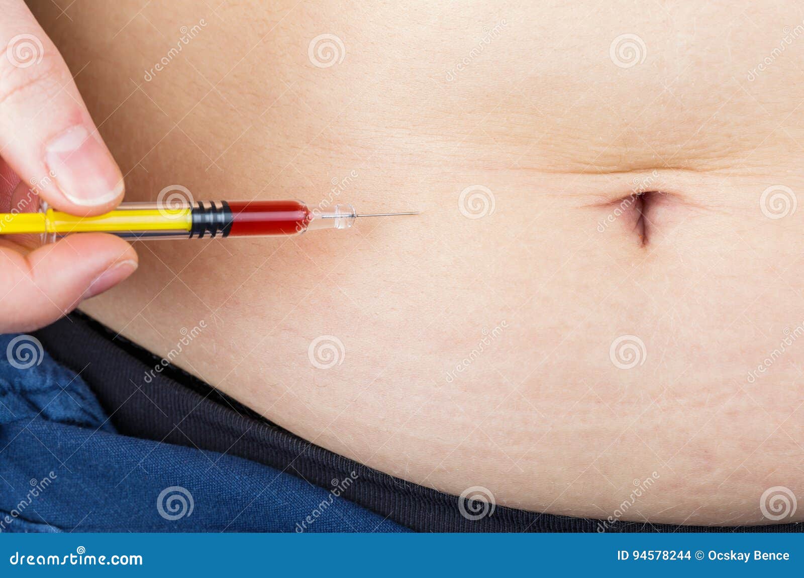 abdominal insulin injection