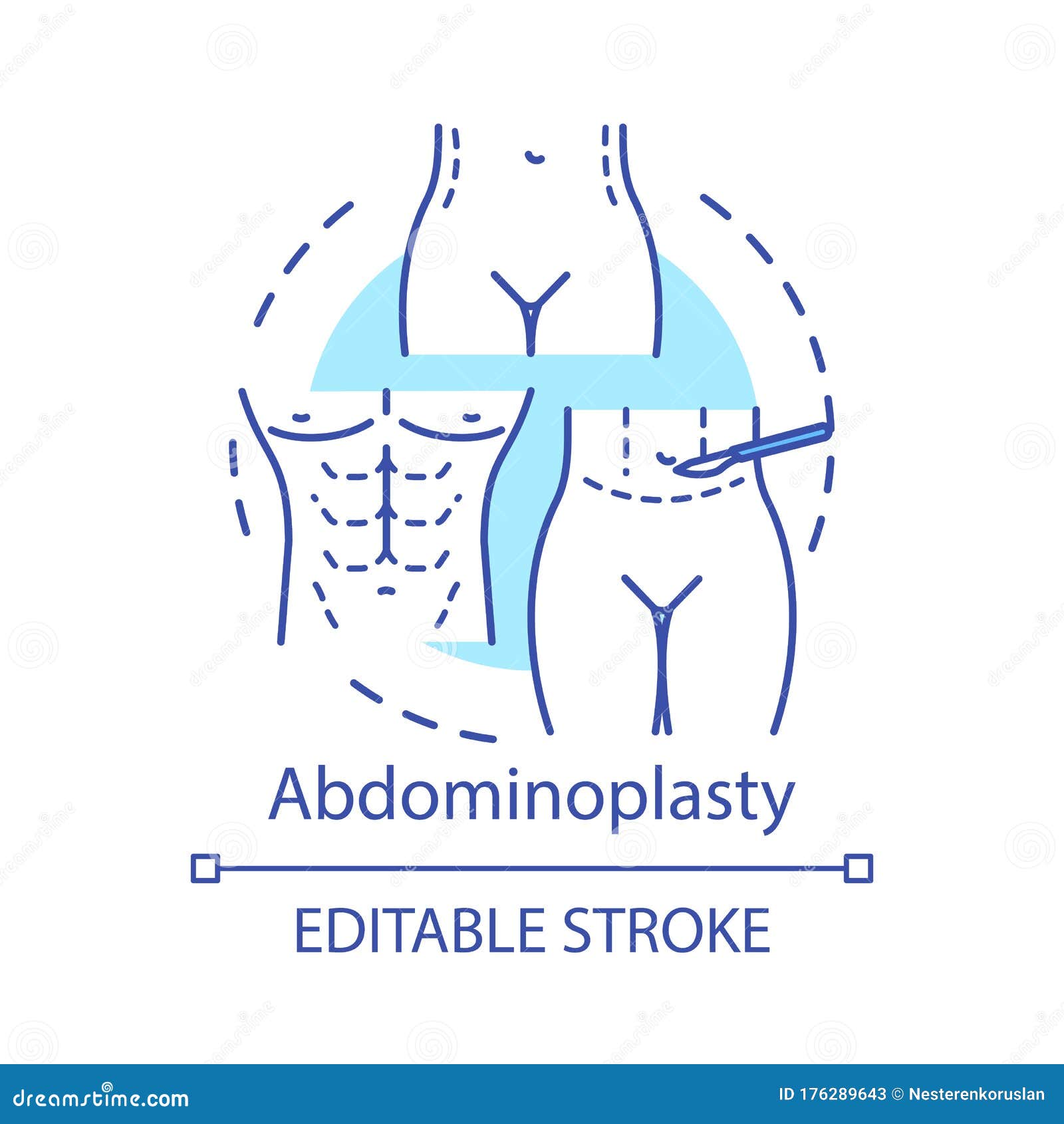 Abdominoplasty Stock Illustrations – 407 Abdominoplasty Stock