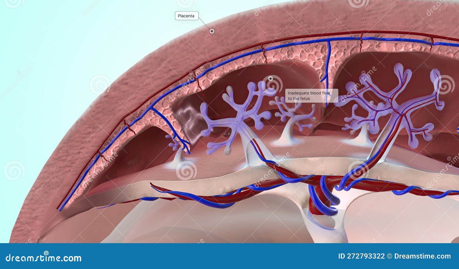 Abnormal Blood Supply To Placenta Stock Image CartoonDealer abnormal-blood-supply-to-placenta-stock-image-cartoondealer