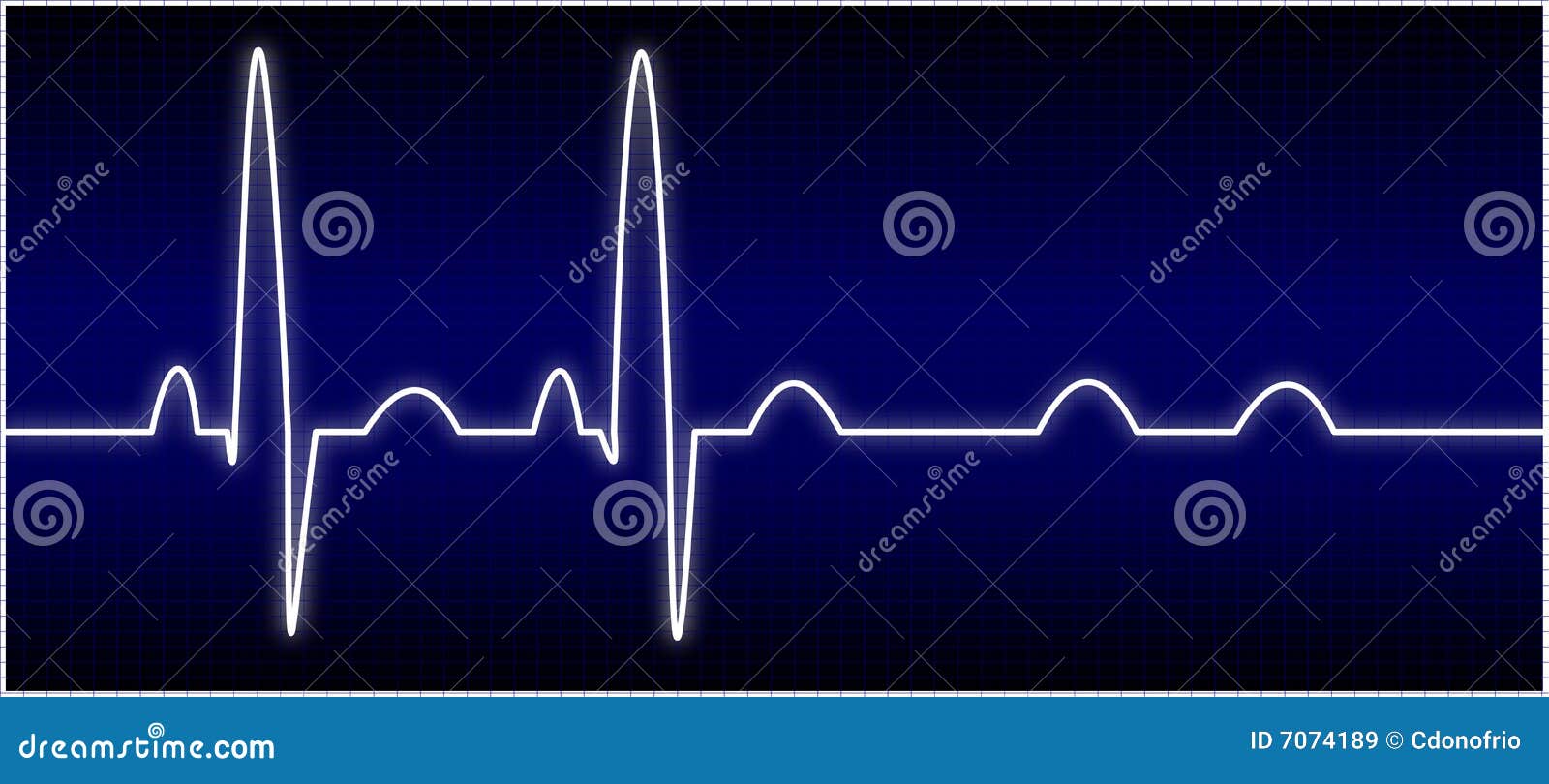 heart test ekg EKG Stock Images Free 7074189 Abnormal Royalty Image: heart test ekg EKG Stock Images Free 7074189 Abnormal Royalty Image: