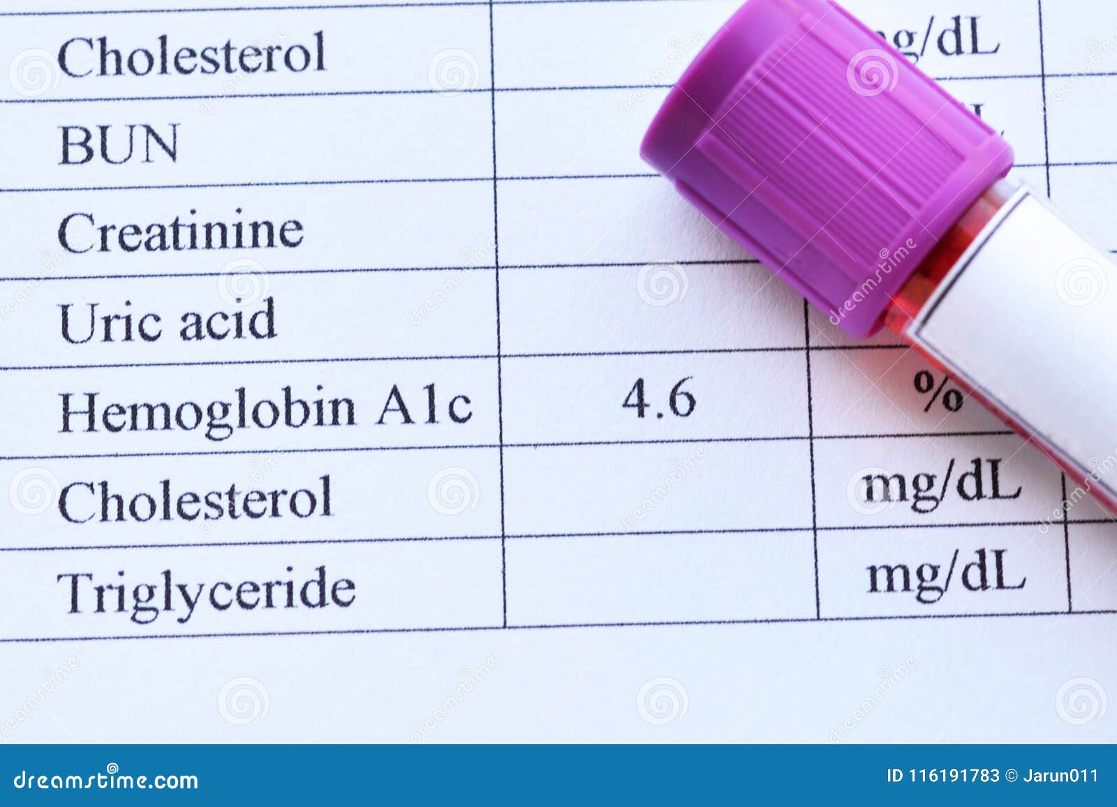 Abnormal High HbA1c Test Result Stock Image Image of blood, sugar