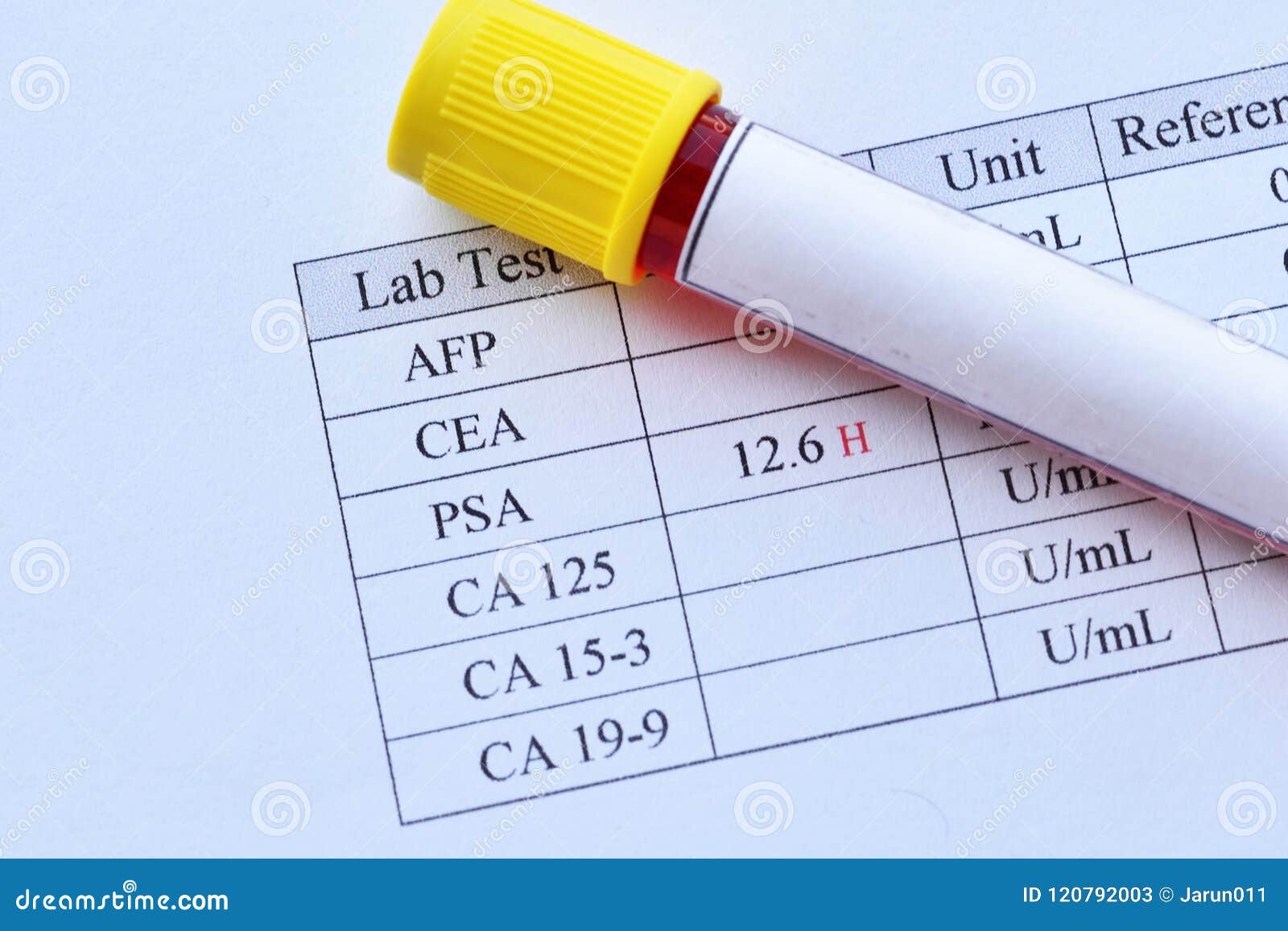 Abnormal Form Shilouette Tree With Cloudy Sky Stock Photo