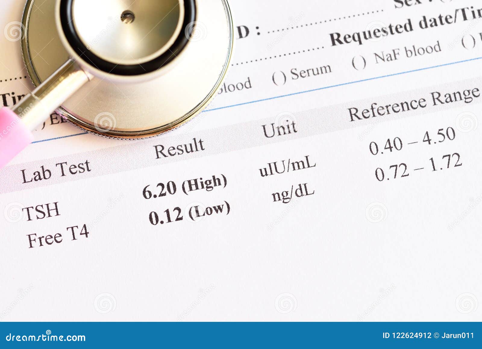 Abnormal thyroid hormone test result