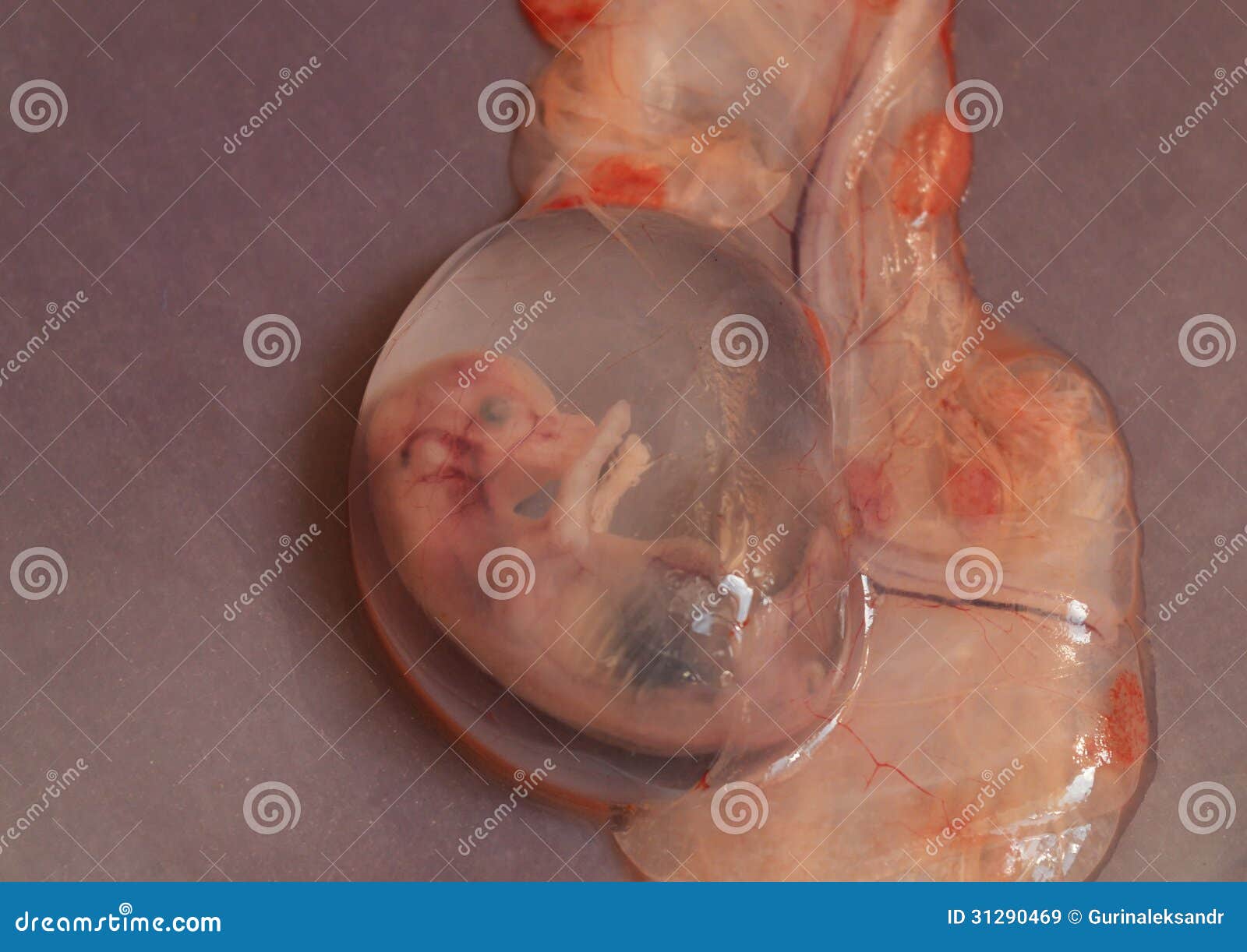 Aborted embryo stock image. Image of anatomy, real, animal - 31290469