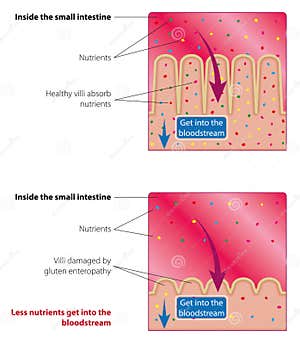 Absorption Of Nutrients In The Small Intestine Stock Vector Illustration Of Duodenum Health Absorption Of Nutrients In The Small Intestine Stock Vector Illustration Of Duodenum Health