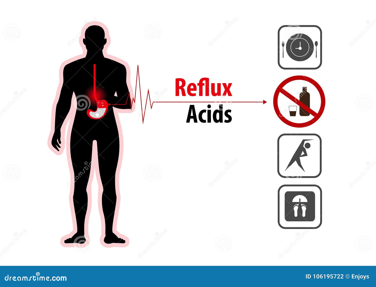 Acid Reflux Heartburn and Gerd Infographic Stock Vector Illustration of health, acid 106195722