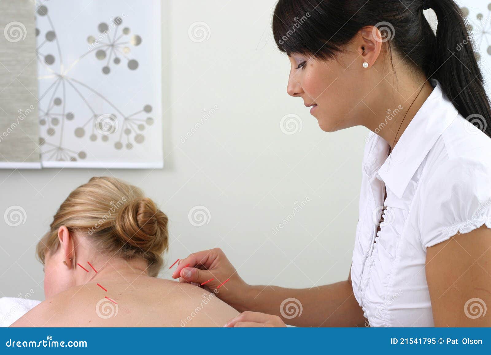 Acupuncture stock image. Image of beautiful, needle, alternative 21541795