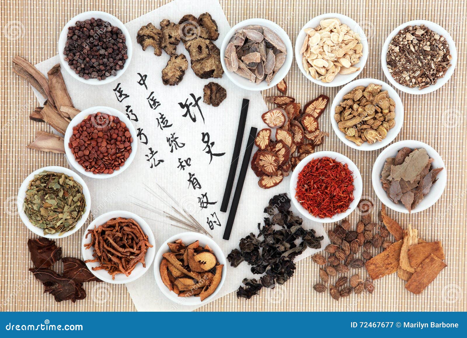 acupuncture chinese medicine