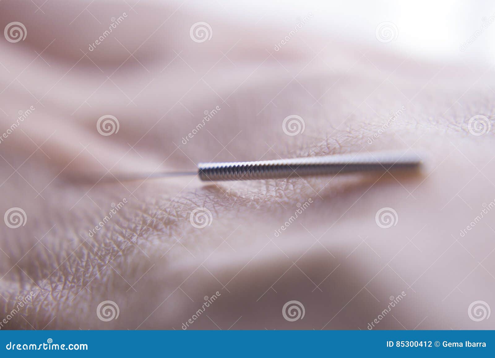 Acupuncture needle stock photo. Image of healthcare, care 85300412