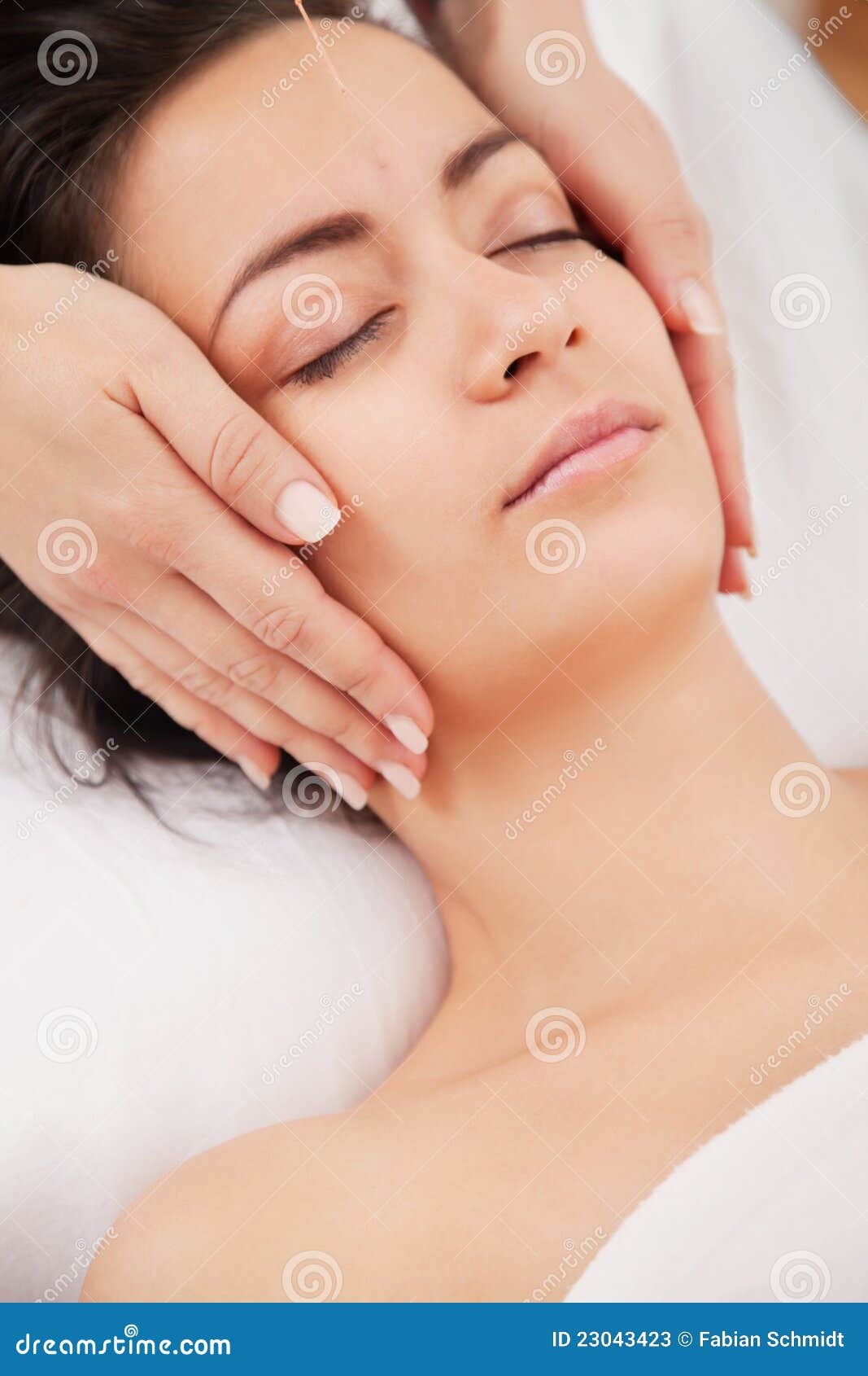 Acupuncture Needles on Head Stock Image Image of alternative, relax