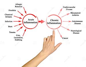Chronic Inflammation Stock Image CartoonDealer 85625629