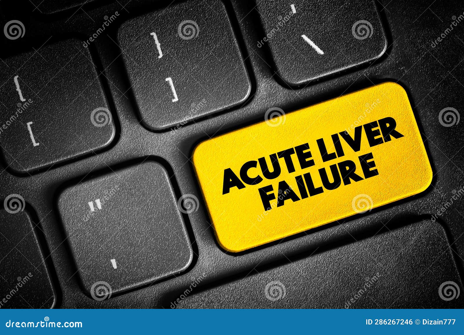 Acute Liver Failure is a Rare Critical Illness with High Mortality