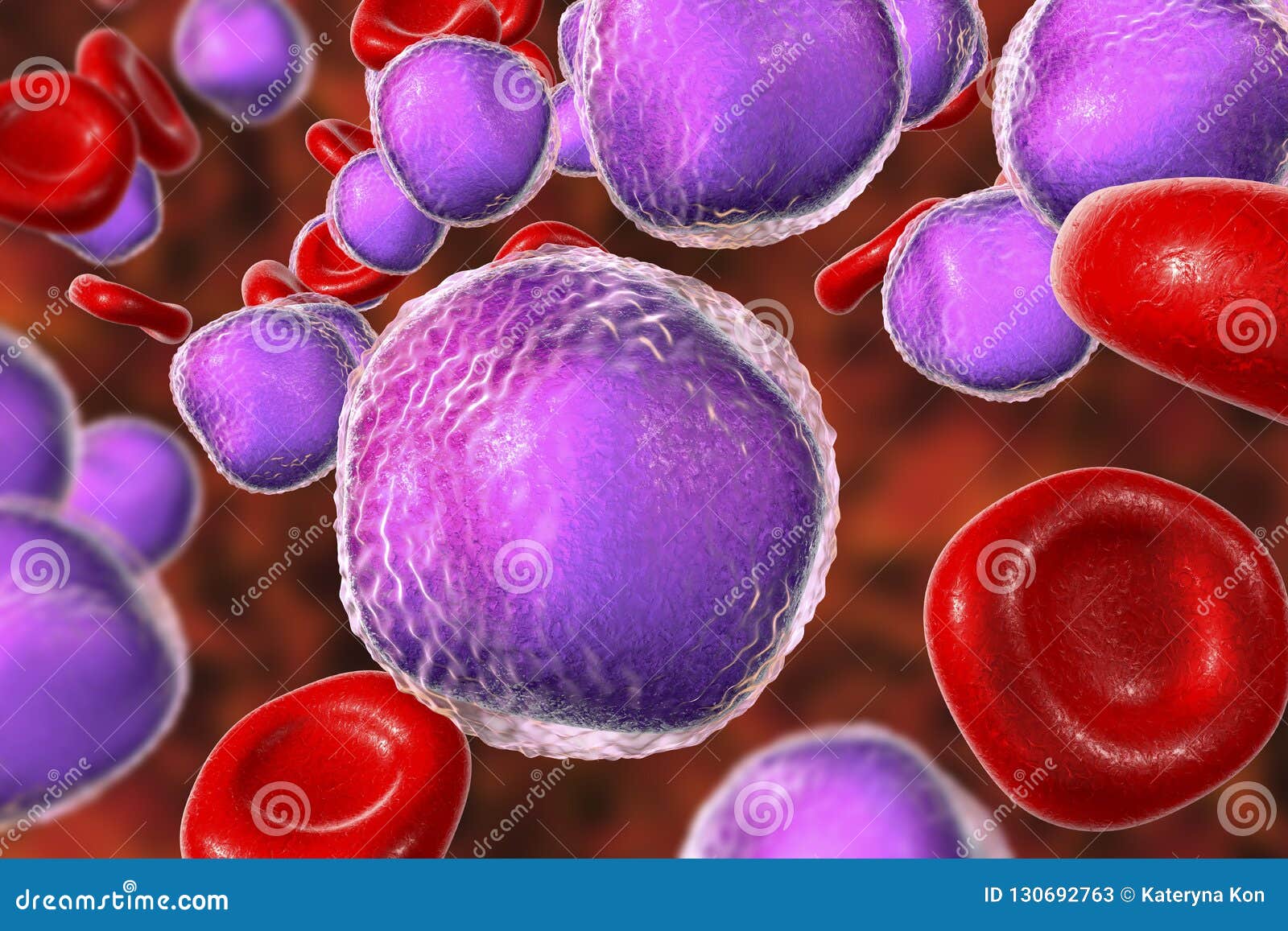 Leukemia Bone Cartoon Vector 43141903