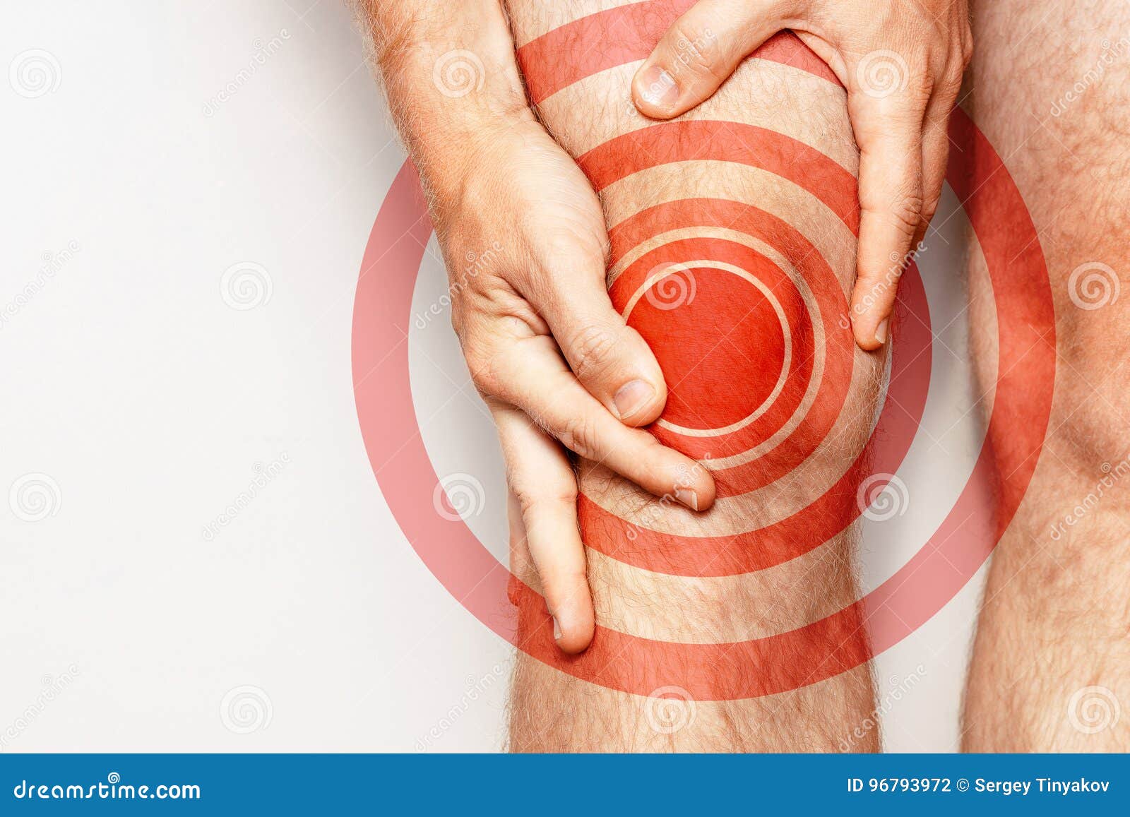 tretman stop artroza oticanje ruke uzrokuje i bol u zglobovima