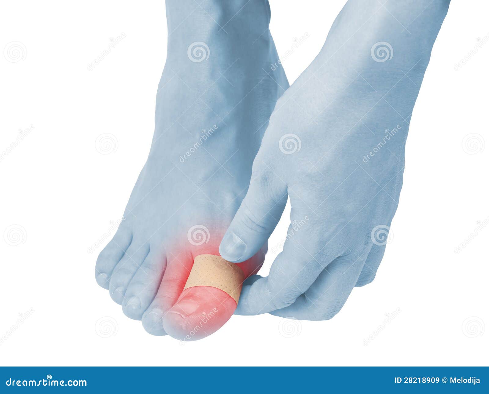 Adhesive Healing Plaster on Foot Finger. Stock Image Image of cure, healthcare 28218909