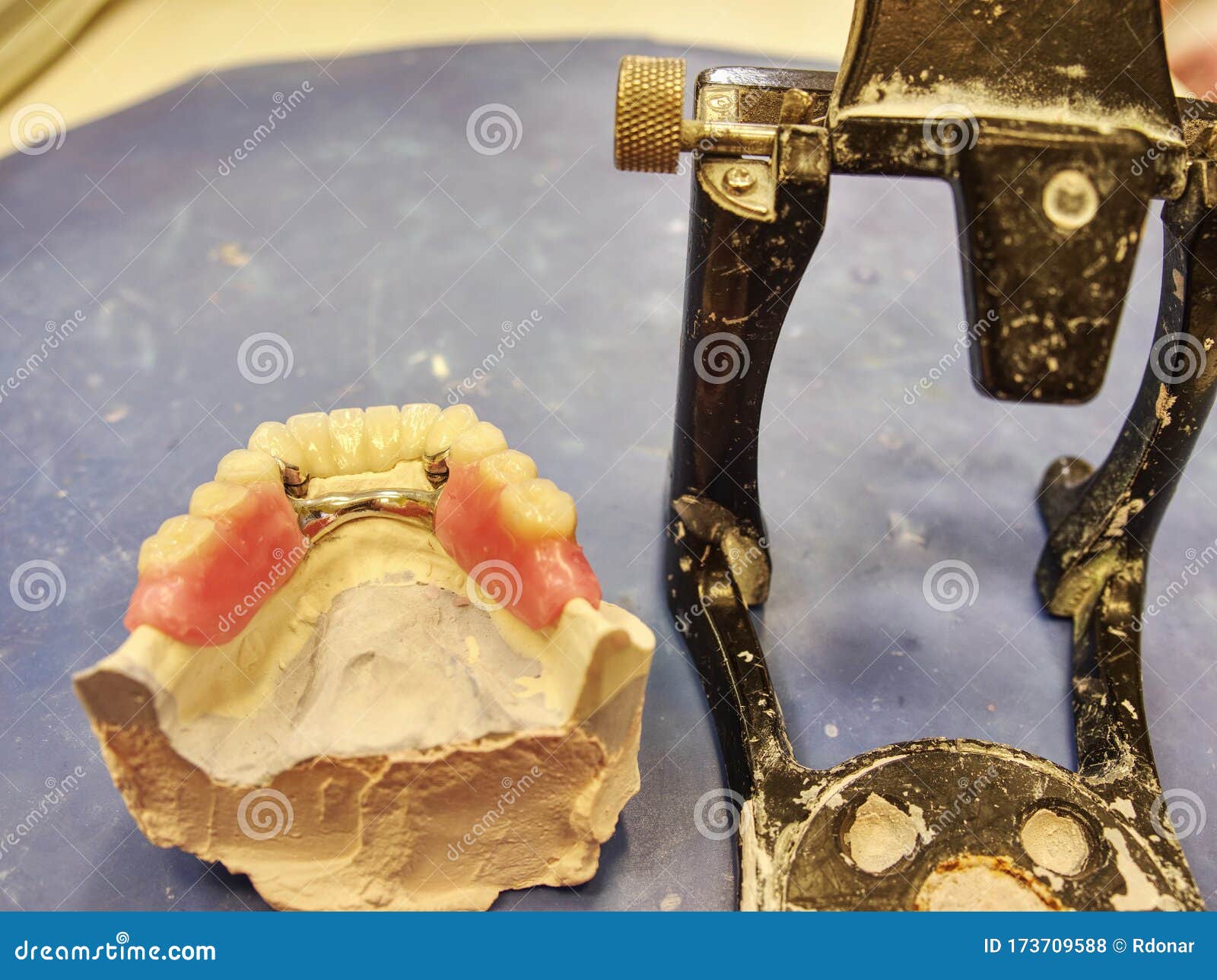 Adjustable Dental Articulator with Teeth Mode Stock Photo Image of