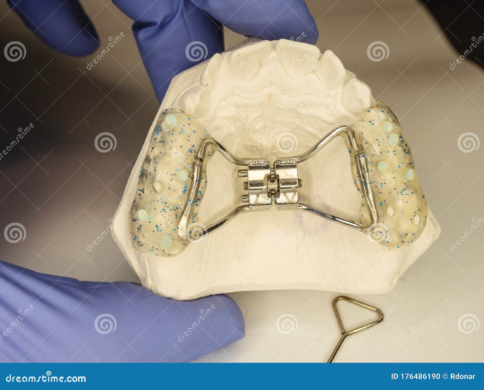 Adjustable Steel Frame Braces for Fix Birth Defect Stock Photo Image of appliance, hyrax