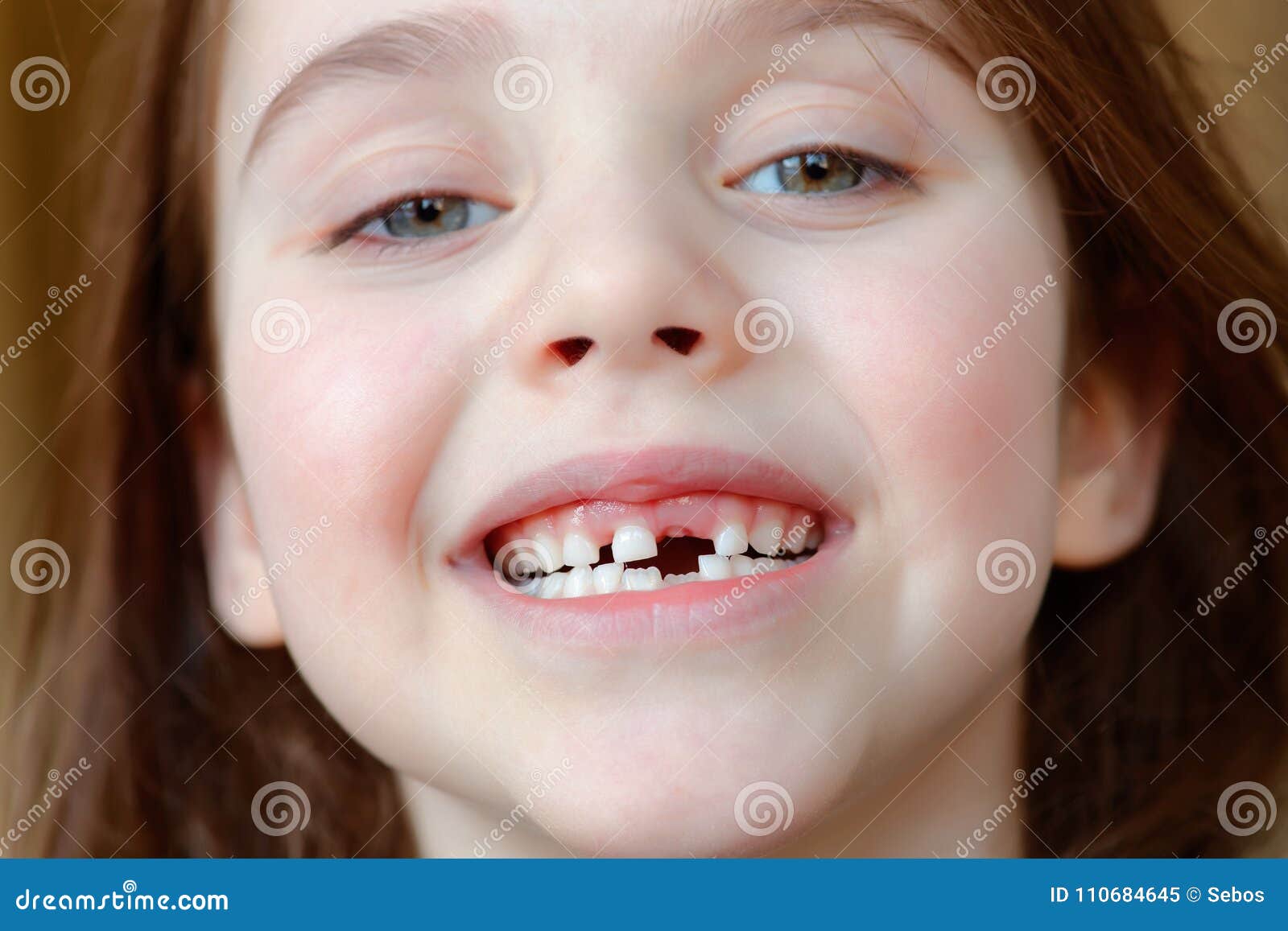 the adorable girl smiles with the fall of the first baby teeth.